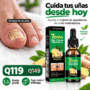 SEFUDUN 7 Days tratamiento para hongos en las uñas de 60 ml con gotero y extracto de jengibre